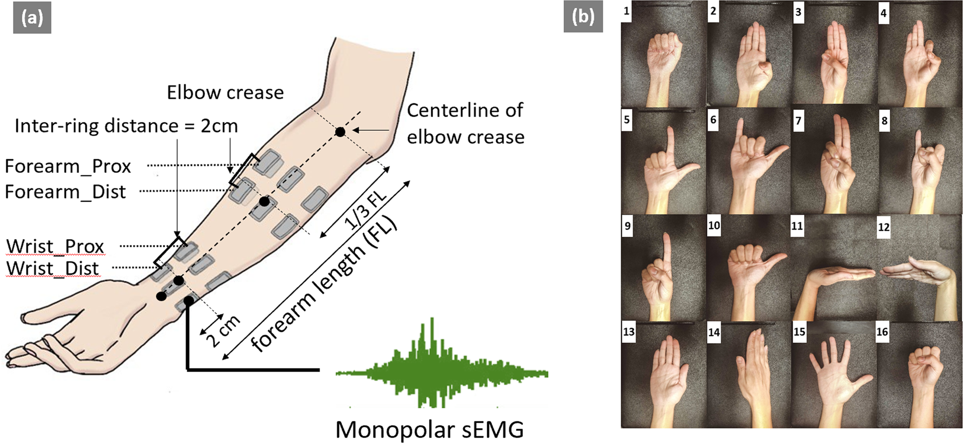 emg